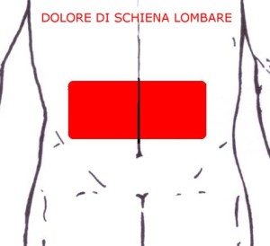 dolore schiena lombare -1-