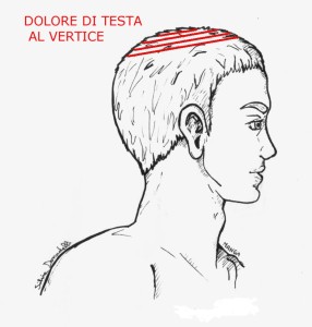 W2° - 63 - dol testa vertice