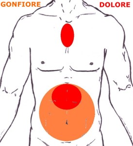 W2°- 65 - DOLORE STOMACO E GONFIORE ADDOME